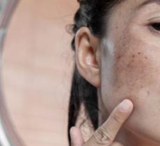 COMMENT ATTÉNUER NATURELLEMENT LES TACHES BRUNES SUR LE VISAGE ? 