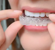 COMMENT NETTOYER UNE GOUTTIÈRE DENTAIRE ? 