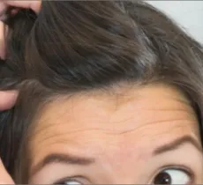 Comment éliminer les pellicules ? les 5 conseils de nos experts cheveux !