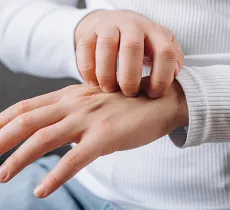 COMMENT EXPLIQUER ET APAISER LES DÉMANGEAISONS CUTANÉES ?