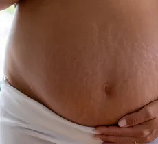 VERGETURES DE GROSSESSE : POURQUOI ET COMMENT LES ATTÉNUER ? 