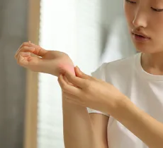 PEAU ATOPIQUE : COMMENT LIMITER ET SOULAGER L'ECZÉMA AU QUOTIDIEN ? 