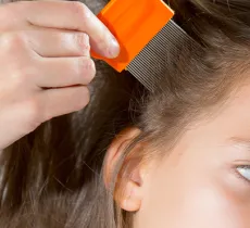 4 remèdes anti-poux naturels !