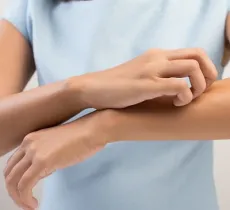 Comment soulager une piqûre de moustique ?&nbsp; nos remèdes naturels !