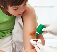 Comment enlever une tache de bétadine ?